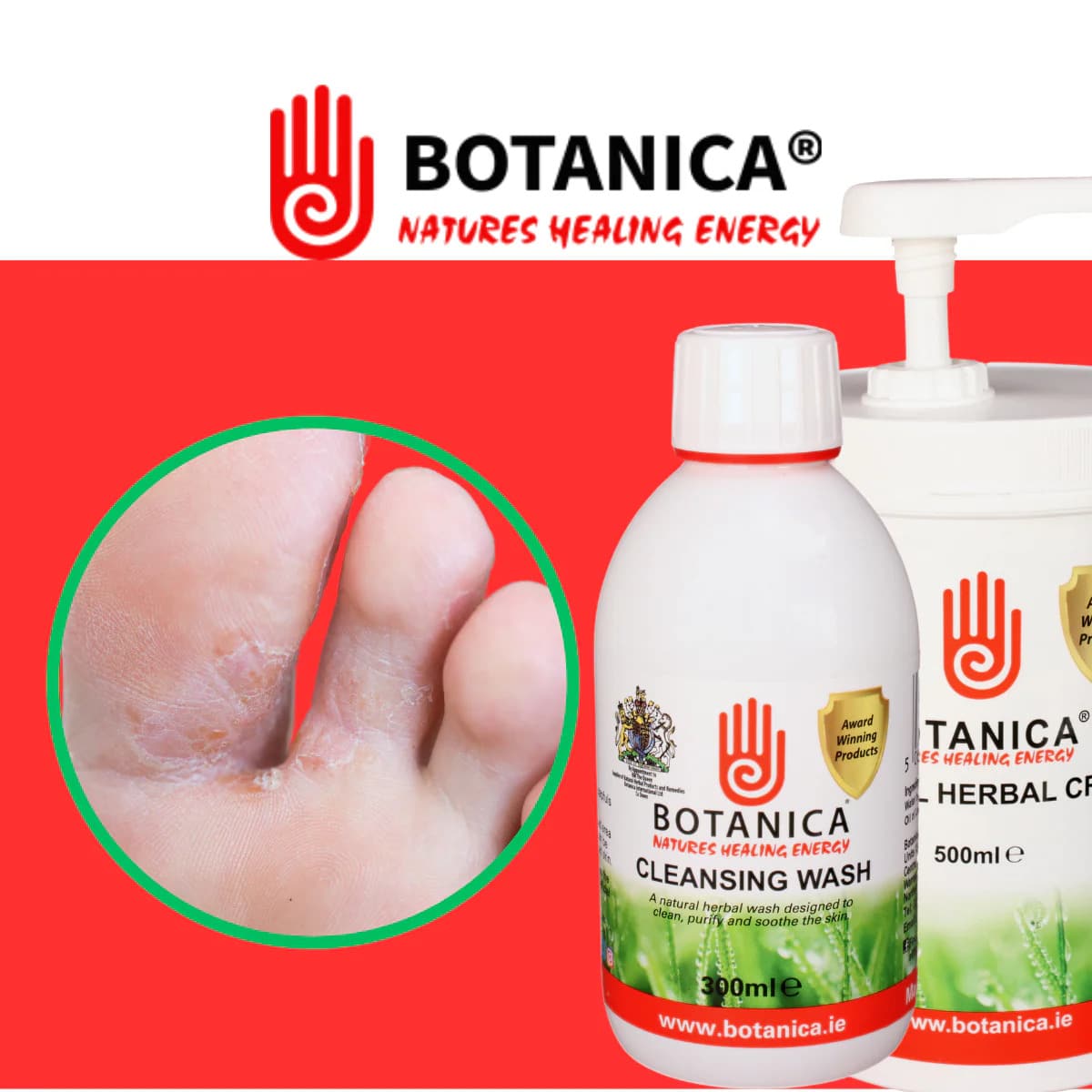 Athlete's Foot Herbal Cream